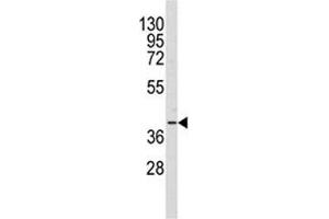 Western blot analysis of AKR1A1 antibody and Y79 lysate (AKR1A1 antibody  (AA 293-325))