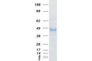 Western Blotting (WB) image for Purinergic Receptor P2x, Ligand-Gated Ion Channel, 3 (P2RX3) protein (Myc-DYKDDDDK Tag) (ABIN2728087)