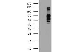 Western Blotting (WB) image for anti-Golgi Membrane Protein 1 (GOLM1) antibody (ABIN1498493) (GOLM1 antibody)