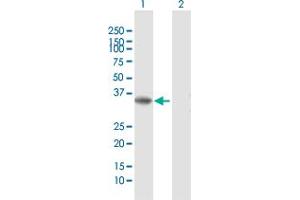 Western Blot analysis of RLBP1 expression in transfected 293T cell line by RLBP1 MaxPab polyclonal antibody. (RLBP1 antibody  (AA 1-317))