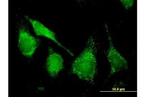 Immunofluorescence of purified MaxPab antibody to CAT on HeLa cell. (Catalase antibody  (AA 1-527))