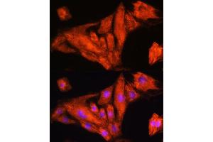 Immunofluorescence analysis of H9C2 cells using Rig-I/DDX58 antibody (ABIN6130263, ABIN6139513, ABIN6139515 and ABIN6217394) at dilution of 1:100. (DDX58 antibody  (AA 726-925))