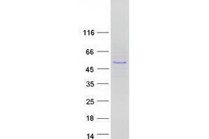 Western Blotting (WB) image for IKAROS Family Zinc Finger 3 (Aiolos) (IKZF3) (Transcript Variant 5) protein (Myc-DYKDDDDK Tag) (ABIN2736142)