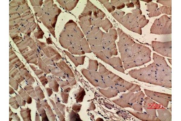 ACTC1 antibody  (N-Term)