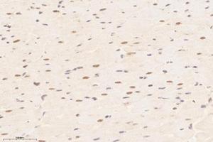 Immunohistochemistry analysis of paraffin-embedded rat heart using,Tin2 (ABIN7075860) at dilution of 1: 7600 (TINF2 antibody)