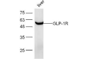 Mouse liver lysates probed with Anti-GLP-1R Polyclonal Antibody, Unconjugated  at 1:5000 for 90 min at 37˚C. (GLP1R antibody  (AA 101-200))