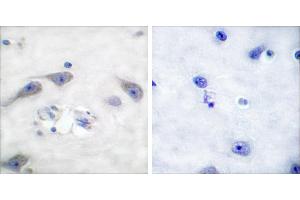 Peptide - +Immunohistochemical analysis of paraffin-embedded human brain tissue using DARPP-32 (Ab-75) antibody (#B0007). (DARPP32 antibody  (Thr75))