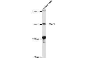 Western blot analysis of extracts of Mouse testis, using  antibody (ABIN1678685, ABIN3015308, ABIN3015309 and ABIN6213977) at 1:1000 dilution. (APAF1 antibody  (AA 1-250))