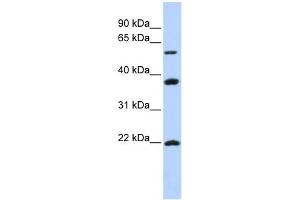 WB Suggested Anti-MYLIP Antibody Titration:  0. (MYLIP antibody  (Middle Region))