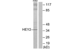 Western Blotting (WB) image for anti-Hairy/enhancer-of-Split Related with YRPW Motif 2 (HEY2) (Internal Region) antibody (ABIN1850038) (HEY2 antibody  (Internal Region))