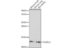 Western blot analysis of extracts of various cell lines, using Profilin1 Polyclonal Antibody (ABIN3021598, ABIN3021599, ABIN3021600 and ABIN6215334) at 1:500 dilution.