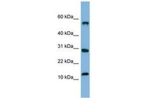 Image no. 1 for anti-Signal Recognition Particle 19kDa (SRP19) (C-Term) antibody (ABIN6741676) (SRP19 antibody  (C-Term))