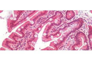 Detection of AXIN2 in Human Small Intestine Tissue using Polyclonal Antibody to Axis Inhibition Protein 2 (AXIN2) (AXIN2 antibody  (AA 350-631))