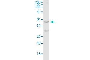 GPRC5A MaxPab polyclonal antibody. (GPRC5A antibody  (AA 1-357))