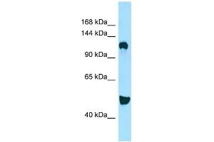WB Suggested Anti-DGKD Antibody Titration: 1.