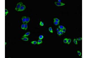 Immunofluorescent analysis of HepG2 cells using ABIN7143426 at dilution of 1:100 and Alexa Fluor 488-congugated AffiniPure Goat Anti-Rabbit IgG(H+L) (Adiponectin Receptor 1 antibody  (AA 1-63))