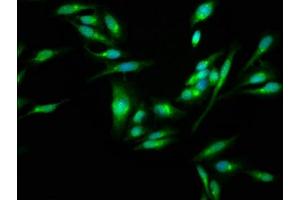 Immunofluorescence staining of Hela cells with ABIN7170595 at 1:100, counter-stained with DAPI. (SKA3 antibody  (AA 101-195))
