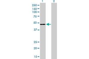 Western Blot analysis of CFH expression in transfected 293T cell line by CFH MaxPab polyclonal antibody. (Complement Factor H antibody  (AA 1-449))