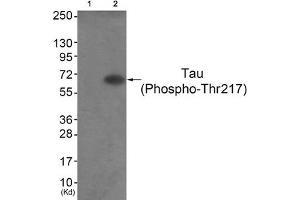 Western blot analysis of extracts from HepG2 cells (Lane 2), using Tau (Phospho-Thr217) Antibody. (MAPT antibody  (pThr217))