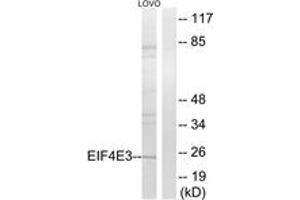 Western blot analysis of extracts from LOVO cells, using EIF4E3 Antibody. (EIF4E3 antibody  (AA 141-190))