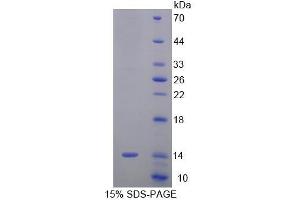 SDS-PAGE analysis of Mouse SRP9 Protein.