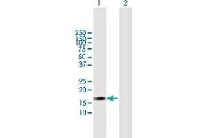 Western Blot analysis of EDN2 expression in transfected 293T cell line by EDN2 MaxPab polyclonal antibody. (Endothelin 2 antibody  (AA 1-178))