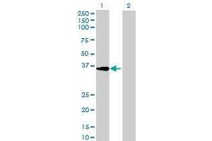 Lane 1: ALKBH3 transfected lysate ( 33. (ALKBH3 293T Cell Transient Overexpression Lysate(Denatured))