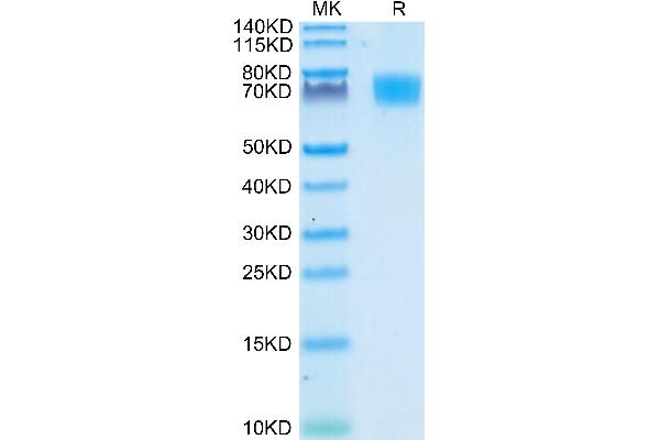 CD166 Protein (AA 28-526) (His tag)