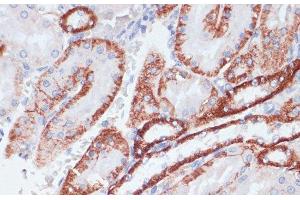 Immunohistochemistry of paraffin-embedded Rat kidney using TFRC Polyclonal Antibody at dilution of 1:100 (40x lens). (Transferrin Receptor antibody)