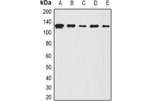 Western blot analysis of BOC expression in A431 (A), Hela (B), mouse lung (C), mouse brain (D), rat spinal cord (E) whole cell lysates. (BOC antibody)