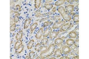 Immunohistochemistry of paraffin-embedded Mouse kidney using GLA Polyclonal Antibody at dilution of 1:100 (40x lens). (GLA antibody)
