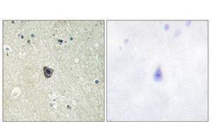 Immunohistochemistry (IHC) image for anti-Colony Stimulating Factor 1 Receptor (CSF1R) (Tyr809) antibody (ABIN1848011) (CSF1R antibody  (Tyr809))