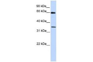 GTF2B antibody used at 0. (GTF2B antibody  (C-Term))