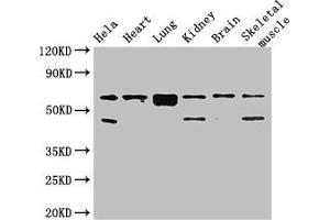 Western Blot Positive WB detected in: Hela whole cell lysate, Mouse heart tissue, Mouse lung tissue, Mouse kidney tissue, Mouse brain tissue, Mouse skeletal muscle tissue All lanes: PRKAA2 antibody at 2. (PRKAA2 antibody  (Catalytic Subunit alpha))