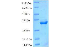 SDS-PAGE (SDS) image for CCHC-Type Zinc Finger, Nucleic Acid Binding Protein (CNBP) (AA 2-170) protein (His-SUMO Tag) (ABIN4974292)