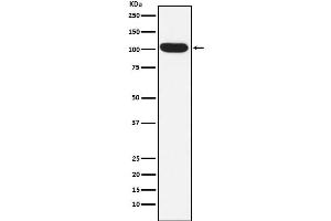 Western blot analysis of ITCH/AIP4 expression in K562 cell lysate.