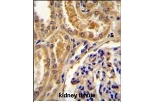 TLL2 Antibody (Center) (ABIN655266 and ABIN2844859) immunohistochemistry analysis in formalin fixed and paraffin embedded human kidney tissue followed by peroxidase conjugation of the secondary antibody and DAB staining. (Tolloid-Like 2 antibody  (AA 298-328))