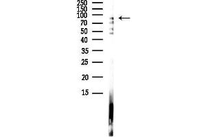 anti-Heat Shock Protein 90kDa alpha (Cytosolic), Class A Member 2 (HSP90AA2) (C-Term) antibody
