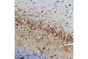 Immunohistochemical analysis of CACNG2 staining in rat brain formalin fixed paraffin embedded tissue section. (Stargazin antibody)