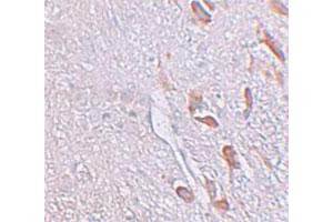 Immunohistochemical staining of human brain cells with LRRTM1 polyclonal antibody  at 5 ug/mL. (LRRTM1 antibody  (C-Term))