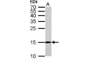 WB Image CDA antibody detects CDA protein by Western blot analysis. (CDA antibody)