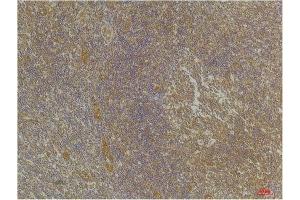 Immunohistochemistry (IHC) analysis of paraffin-embedded Human Tonsil Tissue using CXCR4 Rabbit Polyclonal Antibody diluted at 1:200. (CXCR4 antibody)