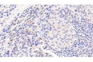 Detection of JNK1 in Human Spleen Tissue using Polyclonal Antibody to c-Jun N-terminal Kinase 1 (JNK1) (C-Jun N-Terminal Kinases (AA 145-419) antibody)