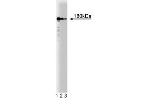 Western blot analysis of Clathrin Heavy Chain on HeLa cell lysate (center). (Clathrin antibody  (AA 4-171))