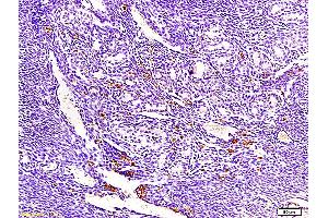 Formalin-fixed and paraffin embedded mouse endometrium tissue labeled with Anti-ECM1 Polyclonal Antibody, Unconjugated (ABIN673071) at 1:300, followed by conjugation to the secondary antibody and DAB staining (ECM1 antibody  (AA 488-567))