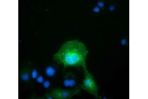 Anti-FAM84B mouse monoclonal antibody (ABIN2453036) immunofluorescent staining of COS7 cells transiently transfected by pCMV6-ENTRY FAM84B (RC207996). (FAM84B antibody)