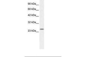 ZFAND6 Antikörper  (AA 125-174)