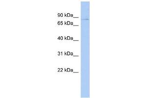 WB Suggested Anti-PHF17 Antibody Titration:  0. (PHF17 antibody  (Middle Region))