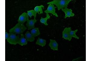 Immunofluorescence staining of A549 cells with ABIN7170322 at 1:50, counter-stained with DAPI. (SOS2 antibody  (AA 187-404))