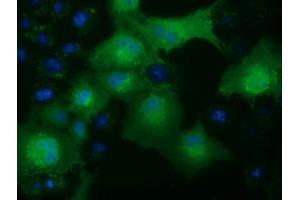Anti-KHK mouse monoclonal antibody (ABIN2453195) immunofluorescent staining of COS7 cells transiently transfected by pCMV6-ENTRY KHK (RC202424). (Ketohexokinase antibody)